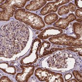 Anti-AK3 antibody produced in rabbit Prestige Antibodies&#174; Powered by Atlas Antibodies, affinity isolated antibody, buffered aqueous glycerol solution