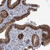 Anti-PDXK antibody produced in rabbit Prestige Antibodies&#174; Powered by Atlas Antibodies, affinity isolated antibody, buffered aqueous glycerol solution, ab2