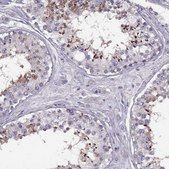 Anti-PRSS54 antibody produced in rabbit Prestige Antibodies&#174; Powered by Atlas Antibodies, affinity isolated antibody, buffered aqueous glycerol solution
