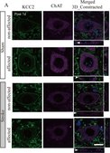 Anti-K+/Cl- Cotransporter (KCC2) Antibody Upstate&#174;, from rabbit