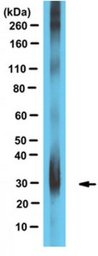 Anti-Apolipoprotein D Antibody serum, from rabbit