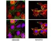 Anti-Beta Catenin Antibody, clone 7F7.2 clone 7F7.2, Upstate&#174;, from mouse