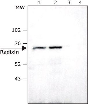 Anti-Radixin antibody produced in rabbit affinity isolated antibody, buffered aqueous solution