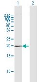 Anti-HMGA1 antibody produced in mouse purified immunoglobulin, buffered aqueous solution