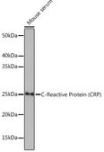 Anti-C-Reactive Protein (CRP) antibody produced in rabbit