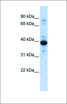 Anti-RNF34 antibody produced in rabbit affinity isolated antibody