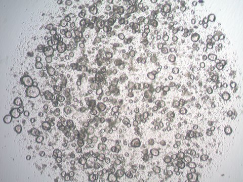 3dGRO Stomach Gastric Organoids, Age 60 (Prep ht-129-S)