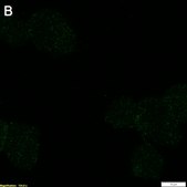 Anti-p-ZAP-70 (Tyr493) Antibody, clone 1F10 ZooMAb&#174; Rabbit Monoclonal recombinant, expressed in HEK 293 cells