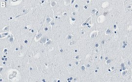 Anti-Rab10 Antibody, clone 1G2 ZooMAb&#174; Rabbit Monoclonal recombinant, expressed in HEK 293 cells