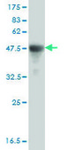 Monoclonal Anti-SMAD2 antibody produced in mouse clone 2D7, purified immunoglobulin, buffered aqueous solution