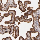 Anti-CFB antibody produced in rabbit Ab3, Prestige Antibodies&#174; Powered by Atlas Antibodies, affinity isolated antibody, buffered aqueous glycerol solution