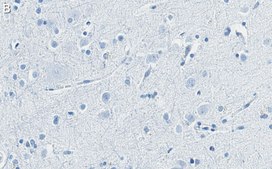 Anti-Substance P Antibody, clone 1K3 ZooMAb&#174; Rabbit Monoclonal recombinant, expressed in HEK 293 cells