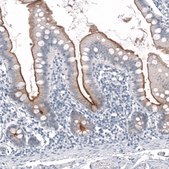 Anti-TMPRSS2 antibody produced in mouse Prestige Antibodies&#174; Powered by Atlas Antibodies, clone CL12511, purified by using Protein A, buffered aqueous glycerol solution