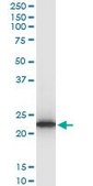 Monoclonal Anti-TPT1, (C-terminal) antibody produced in mouse clone 2C4, purified immunoglobulin, buffered aqueous solution