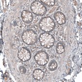 Anti-CSF1R antibody produced in rabbit Prestige Antibodies&#174; Powered by Atlas Antibodies, affinity isolated antibody, buffered aqueous glycerol solution