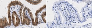 Anti-Angiopoietin-1 Antibody, clone 2F9 ZooMAb&#174; Rabbit Monoclonal recombinant, expressed in HEK 293 cells