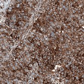 Anti-GSPT1 antibody produced in mouse Prestige Antibodies&#174; Powered by Atlas Antibodies, clone CL13332, purified by using Protein A, buffered aqueous glycerol solution