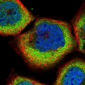 Anti-SLC9A5 antibody produced in rabbit Prestige Antibodies&#174; Powered by Atlas Antibodies, affinity isolated antibody, buffered aqueous glycerol solution