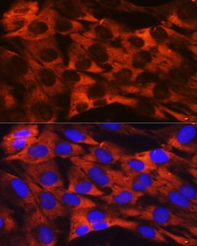Anti-RPS19 antibody produced in rabbit