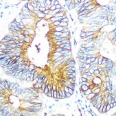 Anti-Aquaporin-1 (AQP1) antibody produced in rabbit