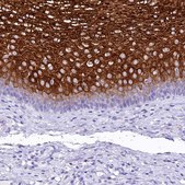 Anti-A2ML1 antibody produced in rabbit Prestige Antibodies&#174; Powered by Atlas Antibodies, affinity isolated antibody, buffered aqueous glycerol solution