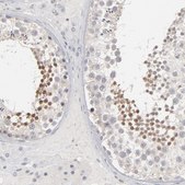 Anti-STAT4 antibody produced in rabbit Prestige Antibodies&#174; Powered by Atlas Antibodies, affinity isolated antibody, buffered aqueous glycerol solution