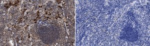 Anti-IL-6 Antibody, clone 1G18 ZooMAb&#174; Rabbit Monoclonal recombinant, expressed in HEK 293 cells