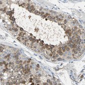 Anti-DLGAP5 antibody produced in rabbit Prestige Antibodies&#174; Powered by Atlas Antibodies, affinity isolated antibody, buffered aqueous glycerol solution