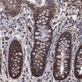 Anti-SOD2 antibody produced in rabbit Prestige Antibodies&#174; Powered by Atlas Antibodies, affinity isolated antibody, buffered aqueous glycerol solution