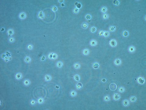 CUTLL1 Human T-cell Lymphoblastic Lymphoma Cell Line