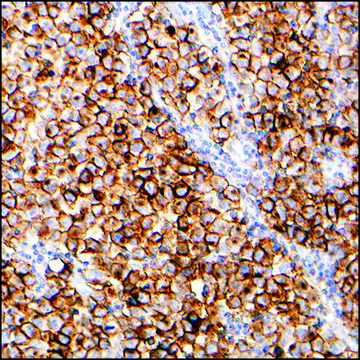 Anti-PLAP antibody, Rabbit monoclonal recombinant, expressed in proprietary host, clone SP15, tissue culture supernatant