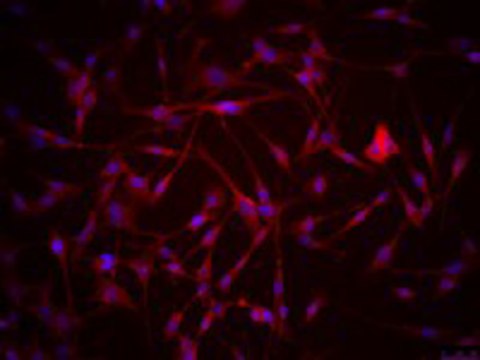 SMA-560 Mouse Orthotopic Glioma Cell Line SMA-560 cell line is a well-established glioma model derived from a spontaneous murine astrocytoma.