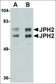 Anti-JPH2 (ab2) antibody produced in rabbit affinity isolated antibody, buffered aqueous solution