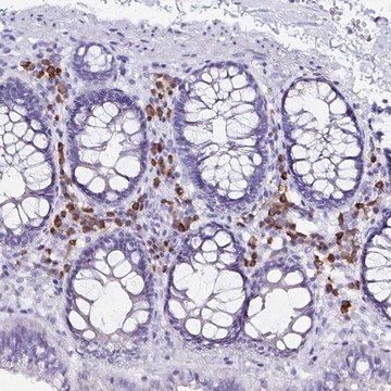 Anti-FNTB antibody produced in rabbit Prestige Antibodies&#174; Powered by Atlas Antibodies, affinity isolated antibody, buffered aqueous glycerol solution