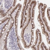 Anti-HNF4G antibody produced in rabbit Prestige Antibodies&#174; Powered by Atlas Antibodies, affinity isolated antibody, buffered aqueous glycerol solution