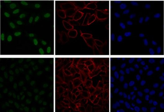 Anti-phospho-ATM (Ser1981) Antibody, clone 10H11.E12, Alexa Fluor&#8482; 488 clone 10H11.E12, from mouse, ALEXA FLUOR&#8482; 488