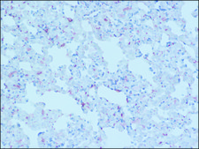 Anti-MR&#8722;Pro ADM antibody produced in rabbit
