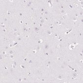 Anti-EHHADH antibody produced in rabbit Prestige Antibodies&#174; Powered by Atlas Antibodies, affinity isolated antibody, buffered aqueous glycerol solution