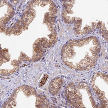 Anti-HDHD2 antibody produced in rabbit Prestige Antibodies&#174; Powered by Atlas Antibodies, affinity isolated antibody, buffered aqueous glycerol solution