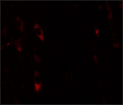 Anti-LRRTM1 antibody produced in rabbit affinity isolated antibody