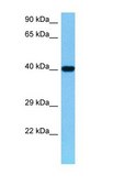 Anti-PRKACB antibody produced in rabbit affinity isolated antibody