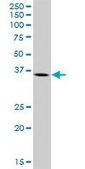 Anti-ARG2 antibody produced in mouse purified immunoglobulin, buffered aqueous solution