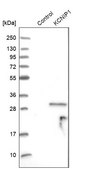 Anti-KCNIP1 antibody produced in rabbit Prestige Antibodies&#174; Powered by Atlas Antibodies, affinity isolated antibody, buffered aqueous glycerol solution