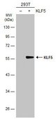 Anti-KLF5 antibody produced in rabbit