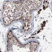 Anti-TXNRD2 antibody produced in rabbit Prestige Antibodies&#174; Powered by Atlas Antibodies, affinity isolated antibody, buffered aqueous glycerol solution