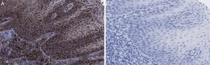 Anti-FAM49A Antibody, clone 2D6 ZooMAb&#174; Rabbit Monoclonal recombinant, expressed in HEK 293 cells