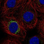 Anti-MPP2 antibody produced in rabbit Prestige Antibodies&#174; Powered by Atlas Antibodies, affinity isolated antibody, buffered aqueous glycerol solution