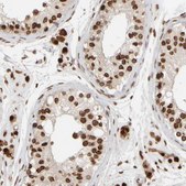 Anti-ZC3HC1 antibody produced in rabbit Prestige Antibodies&#174; Powered by Atlas Antibodies, affinity isolated antibody, buffered aqueous glycerol solution