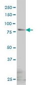 Monoclonal Anti-GLB1 antibody produced in mouse clone 6E7, purified immunoglobulin, buffered aqueous solution