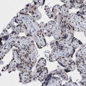 Anti-CBX2 antibody produced in rabbit Prestige Antibodies&#174; Powered by Atlas Antibodies, affinity isolated antibody, buffered aqueous glycerol solution